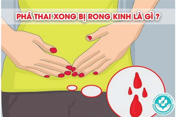 phá thai xong bị rong kinh