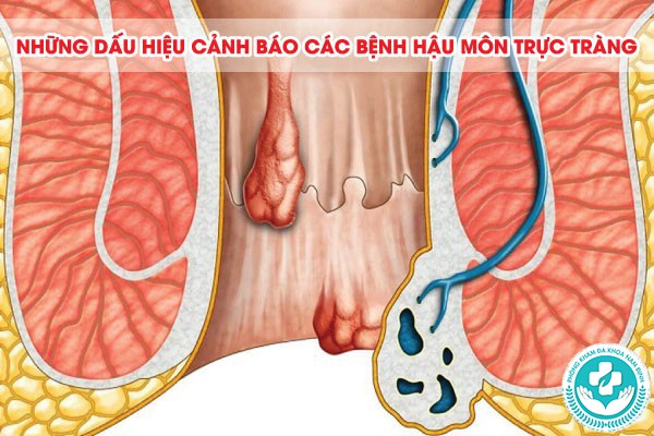 phòng khám chữa bệnh hậu môn trực tràng tại thái bình
