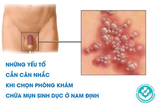 phòng khám chữa mụn sinh dục ở nam định