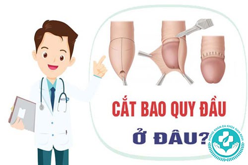 Phương pháp cắt bao quy đầu an toàn