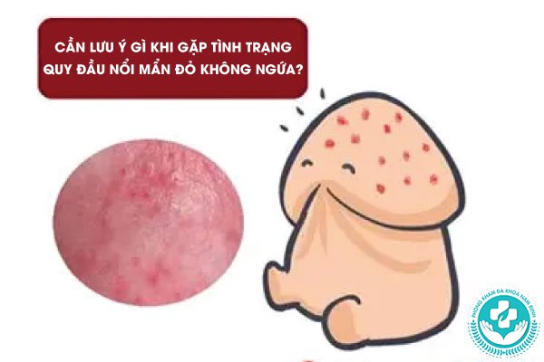 quy đầu nổi mẩn đỏ không ngứa