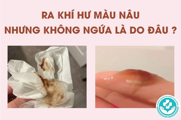 ra khí hư màu nâu nhưng không ngứa