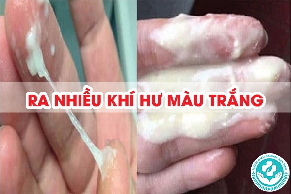 ra nhiều khí hư màu trắng