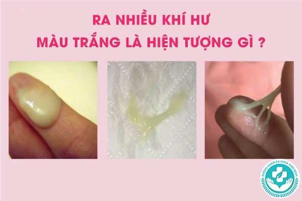 ra nhiều khí hư màu trắng là hiện tượng gì