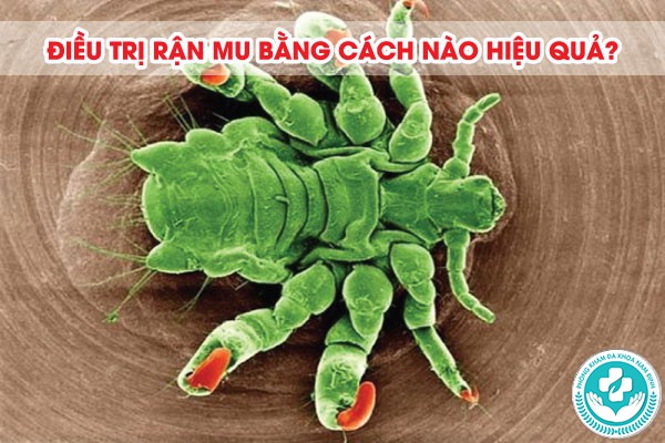 rận mu có tự hết không