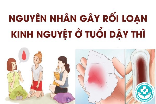 rối loạn kinh nguyệt ở tuổi dậy thì