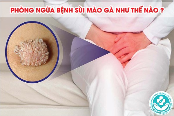 sùi mào gà ở mép vùng kín