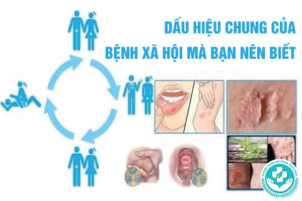 dấu hiệu của bệnh xã hội