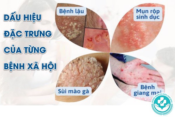 dấu hiệu của bệnh xã hội