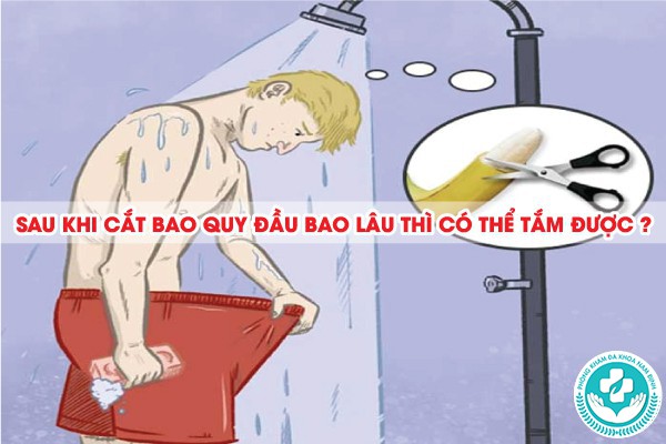 thời gian hồi phục cắt bao quy đầu