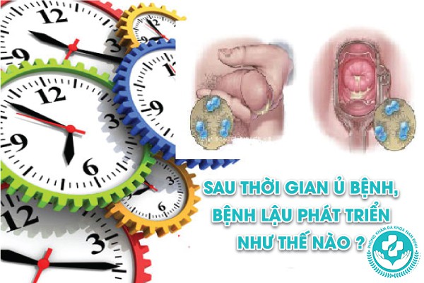 thời gian ủ bệnh của lậu