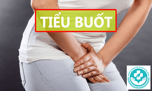 tiểu buốt tiểu nhiều là bệnh gì tiểu buốt tiểu nhiều là bệnh gì
