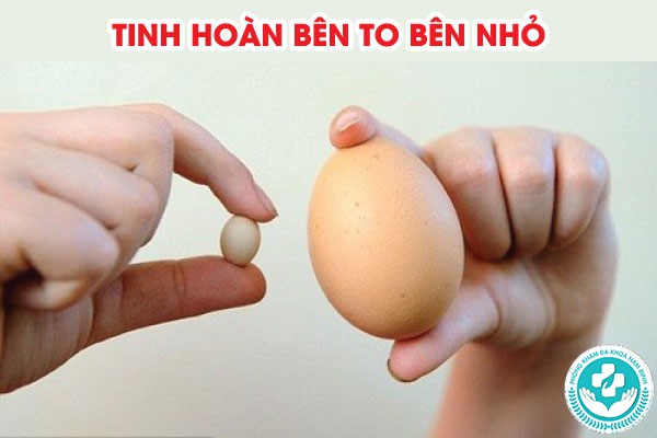 tinh hoàn bên to bên nhỏ