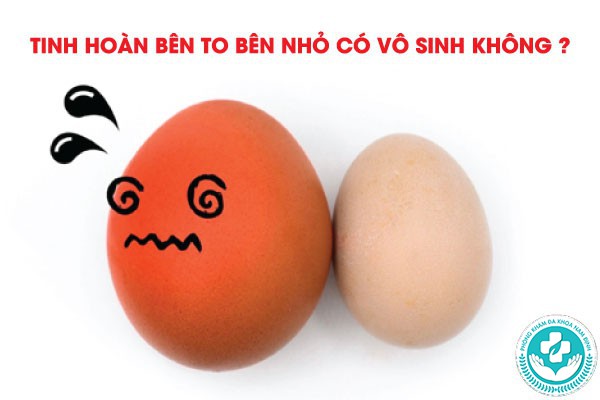 Tinh hoàn bên to bên nhỏ có vô sinh không