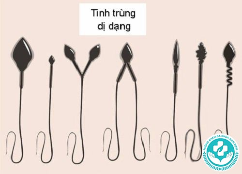 tinh trùng bất thường