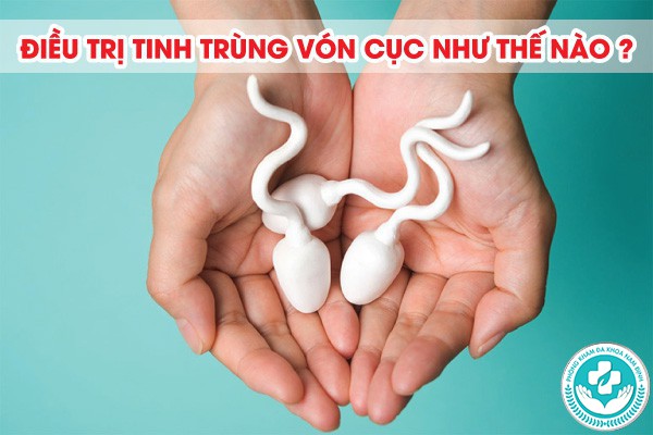 tinh trùng bị vón cục