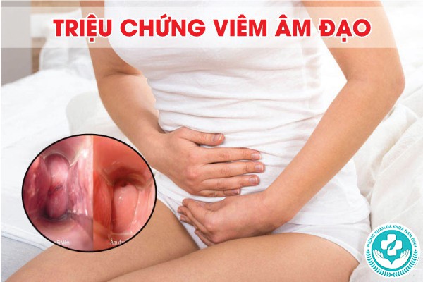 triệu chứng viêm âm đạo