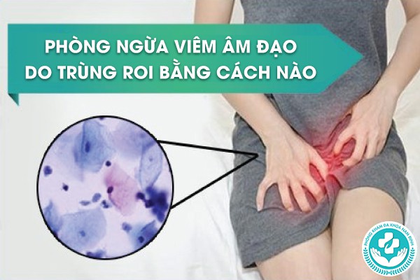 viêm âm đạo do trùng roi