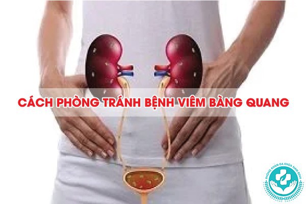 viêm bàng quang
