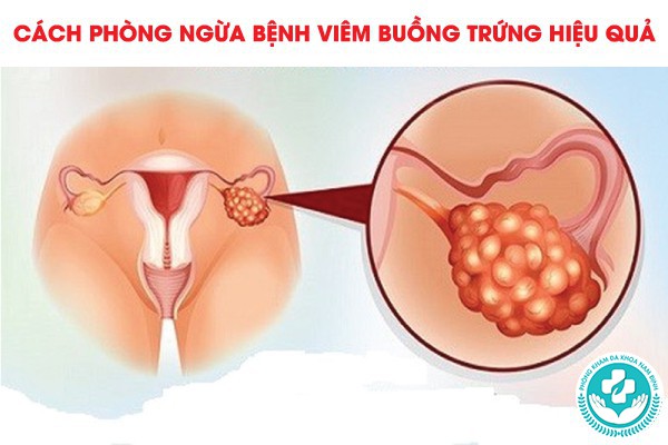 viêm buồng trứng có nguy hiểm không