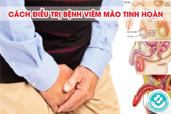 Viêm mào tinh hoàn