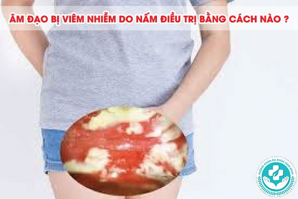viêm nhiễm do nấm