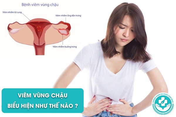 viêm vùng chậu biểu hiện như thế nào