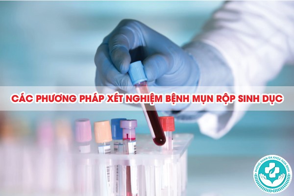 xét nghiệm bệnh mụn rộp sinh dục