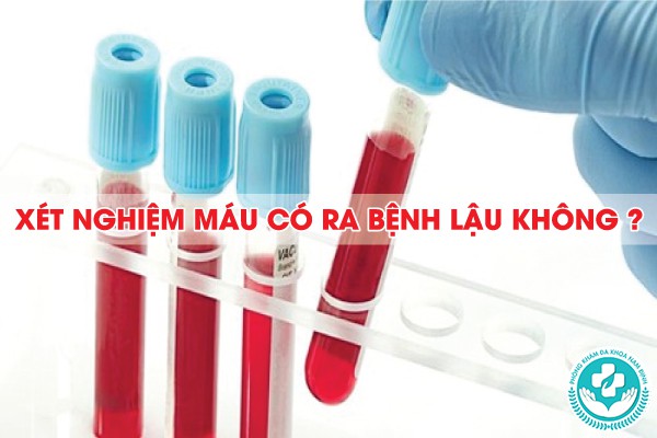 xét nghiệm máu có ra bệnh lậu không