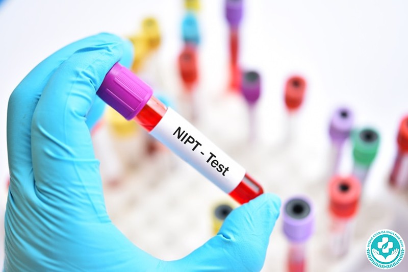 Xét nghiệm tinh trùng ở Hà Nam