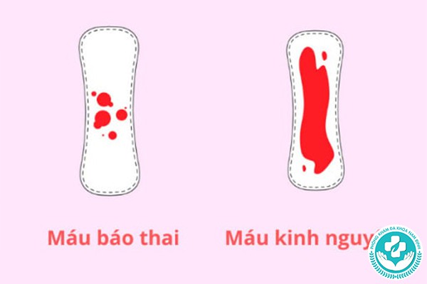 máu báo thai ra trước hay sau kỳ kinh nguyệt