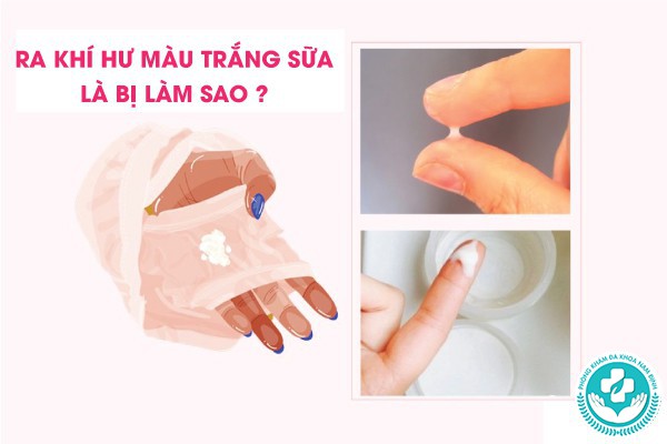 ra khí hư màu trắng sữa là bị làm sao